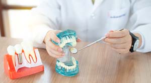 Swiss Denture, Implant FAQ 3