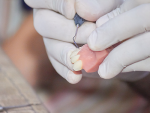 Denture repair in Portland OR | Swiss Denture and Implant Center